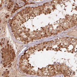 TREML4/TLT-4 Antibody, Novus Biologicals 0.1mL; Unlabeled:Antibodies, Polyclonal