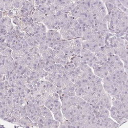 TRERF1 Antibody, Novus Biologicals:Antibodies:Primary Antibodies