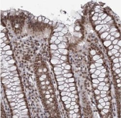 TREX1 Antibody, Novus Biologicals:Antibodies:Primary Antibodies