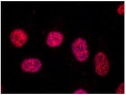 TRF-1 Antibody (TRF-78) - BSA Free, Novus Biologicals 0.025 mL | Buy Online | Novus Biologicals | Fisher Scientific