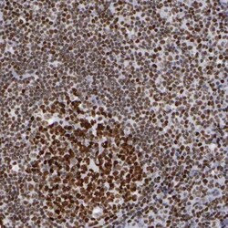 TRF-2 Antibody, Novus Biologicals 25 &mu;L; Unlabeled:Antibodies, Polyclonal