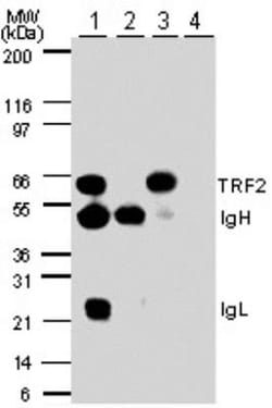 TRF-2 Antibody, Novus Biologicals 0.1mg; Unlabeled:Antibodies, Polyclonal