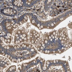 UCH-L3 Antibody, Novus Biologicals:Antibodies:Primary Antibodies