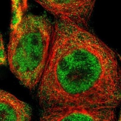 TRIB2 Antibody, Novus Biologicals:Antibodies:Primary Antibodies