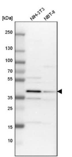 TRIB2 Antibody, Novus Biologicals:Antibodies:Primary Antibodies