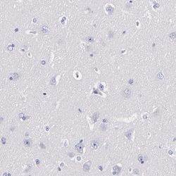 TRIM Antibody, Novus Biologicals 25 &mu;L | Buy Online | Novus Biologicals | Fisher Scientific