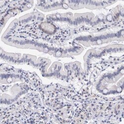 TRIM13 Antibody, Novus Biologicals:Antibodies:Primary Antibodies