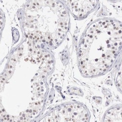 TRIM13 Antibody, Novus Biologicals:Antibodies:Primary Antibodies