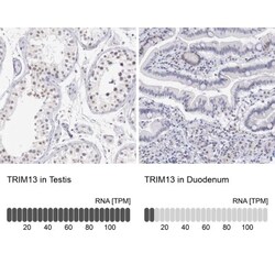 TRIM13 Antibody, Novus Biologicals:Antibodies:Primary Antibodies