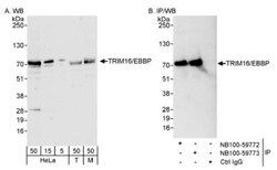 TRIM16 Antibody, Novus Biologicals 0.1mL; Unlabeled:Antibodies, Polyclonal