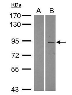 TRIM2 Antibody, Novus Biologicals 0.1mL; Unlabeled:Antibodies, Polyclonal