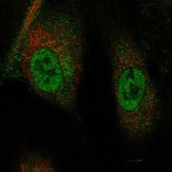 TRIM21/SSA1 Antibody, Novus Biologicals 25 &mu;L; Unlabeled:Antibodies,
