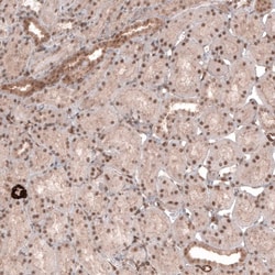 TRIM21/SSA1 Antibody, Novus Biologicals 25 &mu;L; Unlabeled:Antibodies,