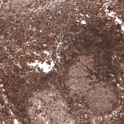 TRIM21/SSA1 Antibody, Novus Biologicals 25 &mu;L; Unlabeled:Antibodies,