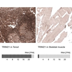 TRIM21/SSA1 Antibody, Novus Biologicals 25 &mu;L; Unlabeled:Antibodies,