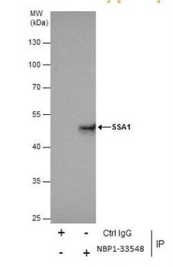 TRIM21/SSA1 Antibody, Novus Biologicals 0.1mg; Unlabeled:Antibodies, Polyclonal