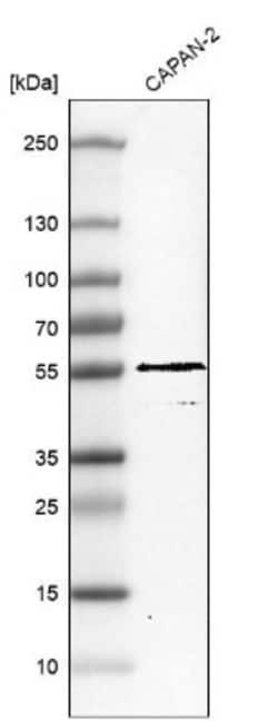 TRIM21/SSA1 Antibody, Novus Biologicals 25 &mu;L; Unlabeled:Antibodies,