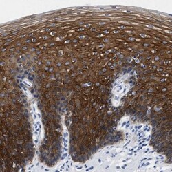 TRIM29 Antibody, Novus Biologicals 25 &mu;L | Buy Online | Novus Biologicals | Fisher Scientific