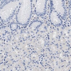 TRIM29 Antibody, Novus Biologicals 25 &mu;L | Buy Online | Novus Biologicals | Fisher Scientific