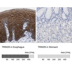 TRIM29 Antibody, Novus Biologicals 25 &mu;L | Buy Online | Novus Biologicals | Fisher Scientific