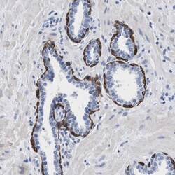 TRIM29 Antibody, Novus Biologicals 25 &mu;L | Buy Online | Novus Biologicals | Fisher Scientific