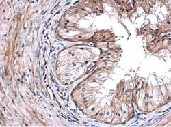 TRIM29 Antibody, Novus Biologicals 0.1mL; Unlabeled:Antibodies, Polyclonal