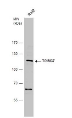 TRIM37 Antibody, Novus Biologicals 0.1 mL | Buy Online | Novus Biologicals | Fisher Scientific