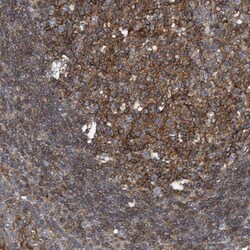 TRIM38 Antibody, Novus Biologicals 0.1mL; Unlabeled:Antibodies, Polyclonal