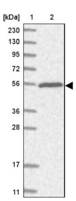 TRIM38 Antibody, Novus Biologicals 0.1mL; Unlabeled:Antibodies, Polyclonal
