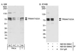 TRIM47 Antibody, Novus Biologicals 0.1mL; Unlabeled:Antibodies, Polyclonal
