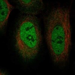 TRIM49D1 Rabbit anti-Human, Polyclonal, Novus Biologicals 100 &mu;g | Buy Online | Novus Biologicals | Fisher Scientific