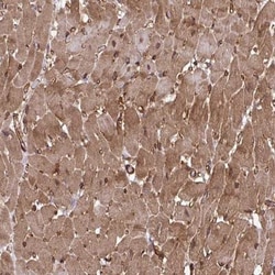 TRIM52 Antibody, Novus Biologicals 25 &mu;L, Unlabeled:Antibodies, Polyclonal