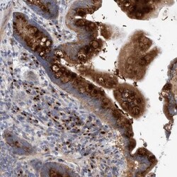 TRIM58 Antibody, Novus Biologicals 25 &mu;L | Buy Online | Novus Biologicals | Fisher Scientific