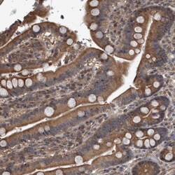 TRIM65 Antibody, Novus Biologicals:Antibodies:Primary Antibodies