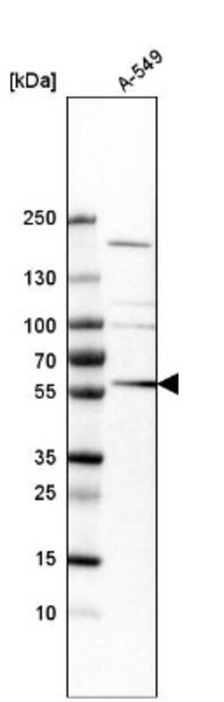 TRIM65 Antibody, Novus Biologicals:Antibodies:Primary Antibodies