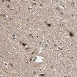 TRIO Antibody, Novus Biologicals:Antibodies:Primary Antibodies