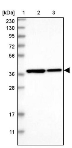 TRIP1 Antibody, Novus Biologicals 0.1mL; Unlabeled:Antibodies, Polyclonal
