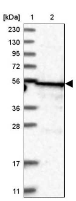 TRIT1 Antibody, Novus Biologicals 25 &mu;L; Unlabeled:Antibodies, Polyclonal