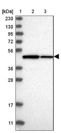 TRMT12 Antibody, Novus Biologicals 25 &mu;L; Unlabeled:Antibodies, Polyclonal