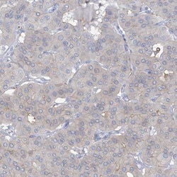 TRMT2B Antibody, Novus Biologicals 25 &mu;L | Buy Online | Novus Biologicals | Fisher Scientific
