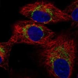TRMT61A Rabbit anti-Human, Polyclonal, Novus Biologicals:Antibodies:Primary
