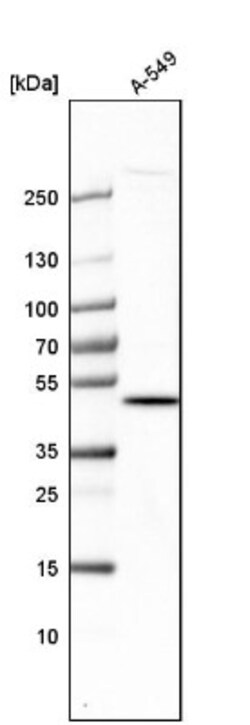 CENPP Antibody, Novus Biologicals:Antibodies:Primary Antibodies
