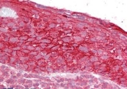 TROP-2 Antibody, Novus Biologicals 0.1mg; Unlabeled:Antibodies, Polyclonal