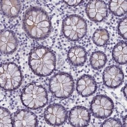 TROP-2 Antibody, Novus Biologicals 25 &mu;L | Buy Online | Novus Biologicals | Fisher Scientific