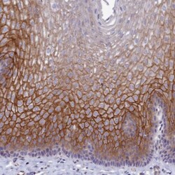 TROP-2 Antibody, Novus Biologicals 25 &mu;L | Buy Online | Novus Biologicals | Fisher Scientific