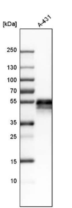 TROP-2 Antibody, Novus Biologicals 25 &mu;L | Buy Online | Novus Biologicals | Fisher Scientific