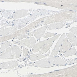 Tyrosylprotein Sulfotransferase 2/TPST2 Antibody, Novus Biologicals:Antibodies:Primary