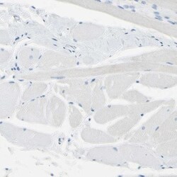 TRP2 Antibody, Novus Biologicals 25 &mu;L; Unlabeled:Antibodies, Polyclonal