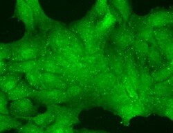 TRP7 Antibody (N64A/36), Novus Biologicals 0.1mg; Unlabeled:Antibodies,