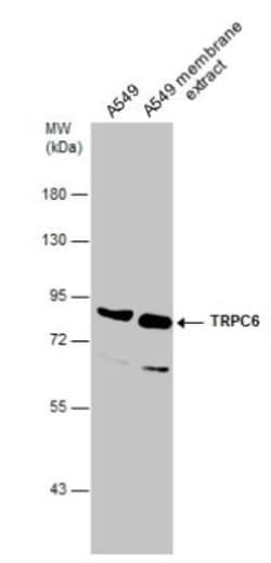 TRPC6 Antibody, Novus Biologicals 0.1mg; Unlabeled:Antibodies, Polyclonal